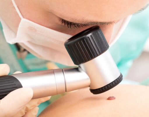 Ученые научились выявлять рак мозга на ранней стадии по анализу мочи