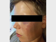 МИД обратил внимание на избиение русского мальчика в Киргизии