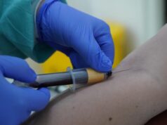 Врач назвал необязательным замер уровня антител перед прививкой