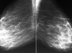 Найден способ борьбы с неизлечимым раком груди