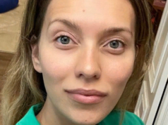 Обнаженная Тодоренко с разбитой головой шокировала публику